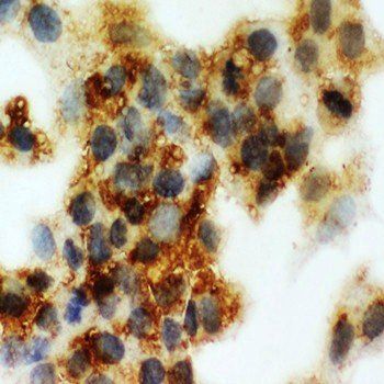 Anti-Cortisol Binding Globulin/SERPINA6 Antibody