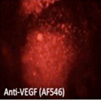 VEGFA Antibody