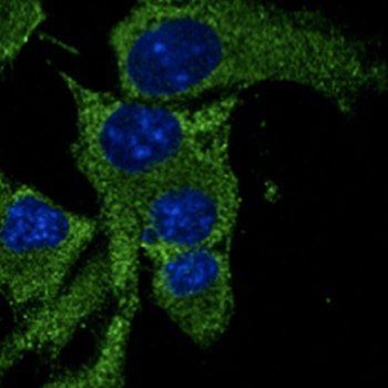P53 Antibody