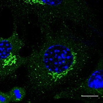 Rab3 antibody