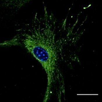 Rab27 antibody