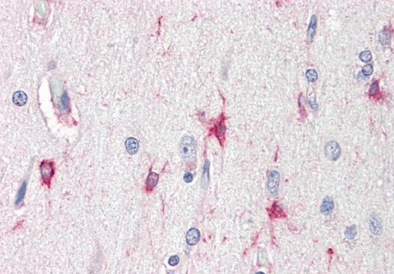 BAG3 antibody