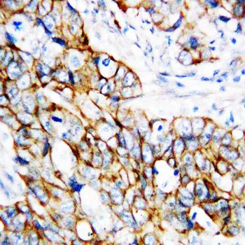 Anti-beta Catenin/CTNNB1 Antibody