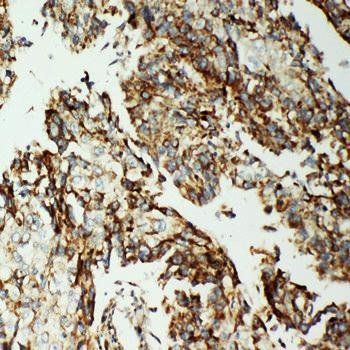 Anti-AIF/AIFM1 Antibody