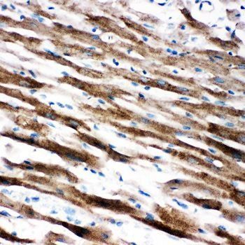 Anti-AIF/AIFM1 Antibody