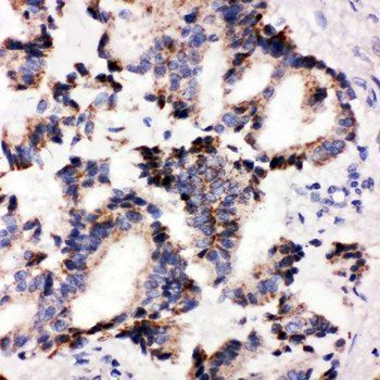 Anti-IRAK2 Antibody