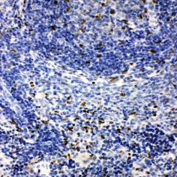 Anti-IRAK2 Antibody