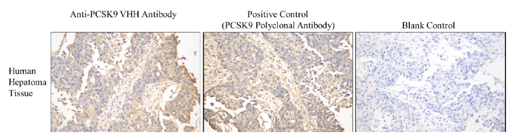 Anti-PCSK9 VHH Antibody, clone LDL7
