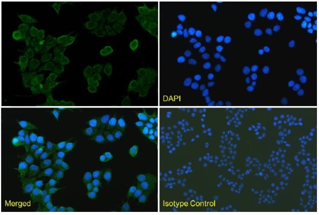 Anti-EGFR VHH antibody