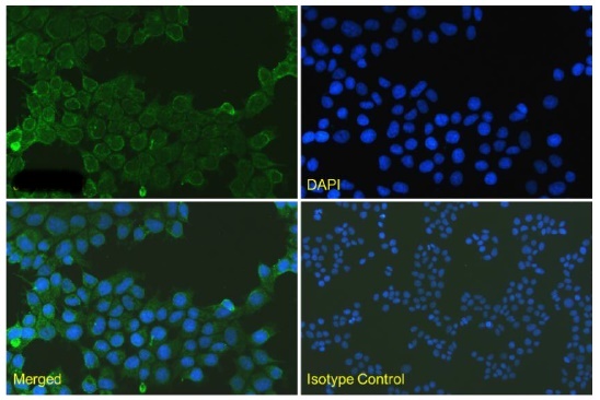 Anti-Her2 VHH antibody