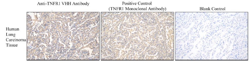 Anti-hTNFR1 VHH antibody