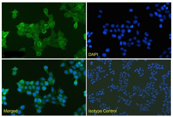 Anti-hTNFR1 VHH antibody