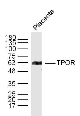 TPOR antibody