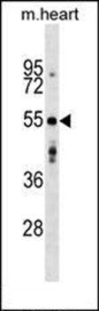 AGPAT9 antibody