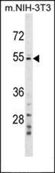 GPT2 antibody