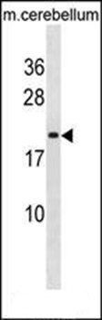 LIN7B antibody