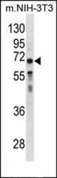 GGT1 antibody