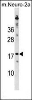RPL30 antibody