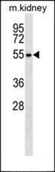 RPS6KL1 antibody