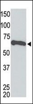 Myc Tag antibody