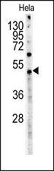 Myc Tag antibody