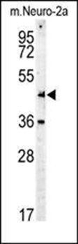 Myc Tag antibody