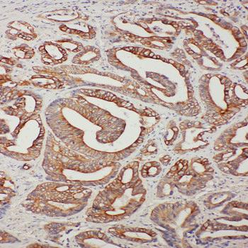 Anti-TNFAIP8L3 Antibody