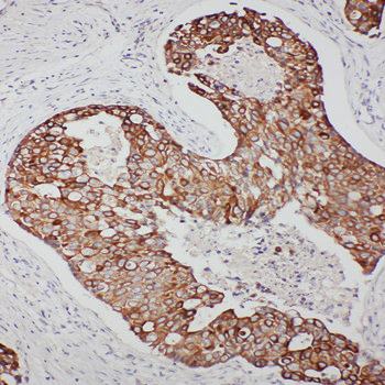 Anti-TNFAIP8L3 Antibody