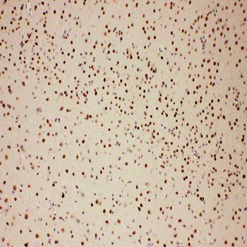 Anti-E3 SUMO-protein ligase PIAS1 PIAS1 Antibody