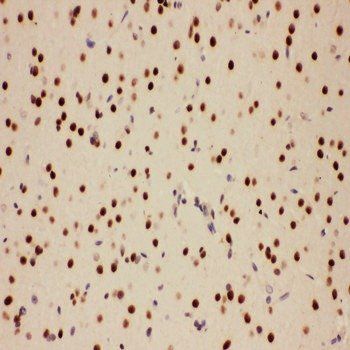 Anti-E3 SUMO-protein ligase PIAS1 PIAS1 Antibody