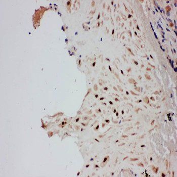 Anti-E3 SUMO-protein ligase PIAS1 PIAS1 Antibody