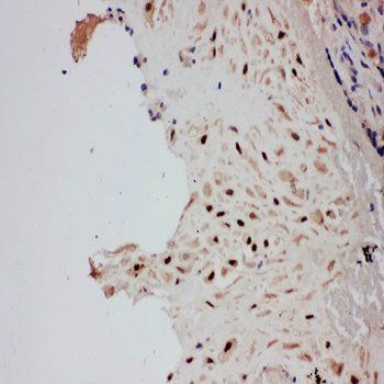 E3 SUMO-protein ligase PIAS1 PIAS1 Antibody