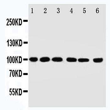Anti-E3 SUMO-protein ligase PIAS1 PIAS1 Antibody