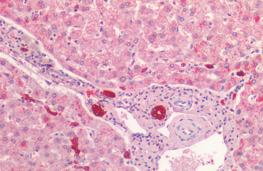 Goat anti-cytokeratin 19 Antibody
