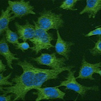 Anti-Clathrin HC