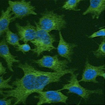 Clathrin HC antibody