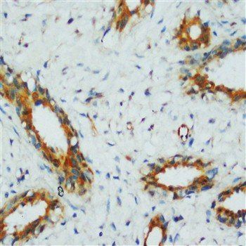 PP2A-alpha/PPP2CA Antibody