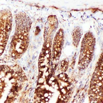 Anti-Hsp70/HSPA1A/HSPA1B Antibody