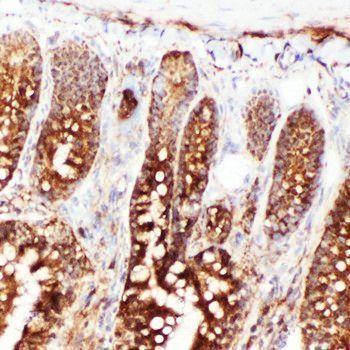 Hsp70/HSPA1A/HSPA1B Antibody