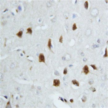 Hsp70/HSPA1A/HSPA1B Antibody