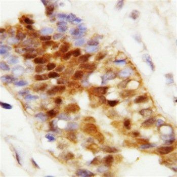 Anti-Hsp70/HSPA1A/HSPA1B Antibody