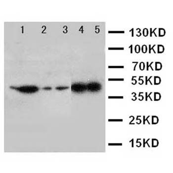 Anti-Decorin/DCN Antibody