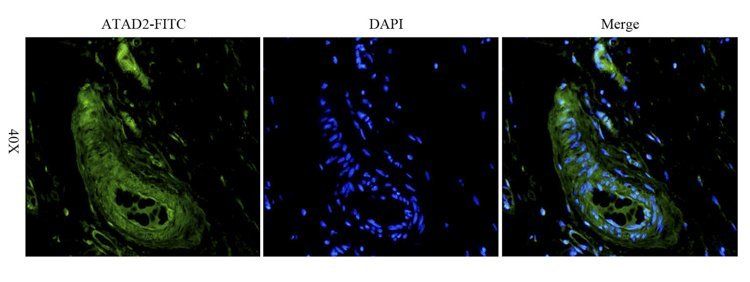 ATAD2 antibody (FITC)