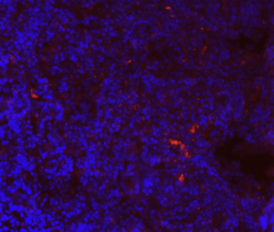 CoREST2 Rabbit Polyclonal Antibody