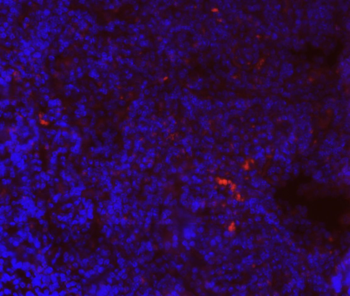 CoREST2 antibody