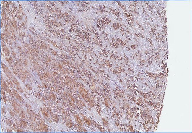 HS6ST2 Rabbit Polyclonal Antibody