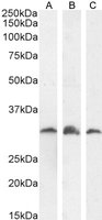 Goat anti-PI31 / PSMF1 (Isoform 1) Antibody