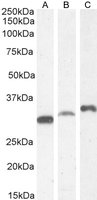 Goat anti-PI31 / PSMF1 (Isoform 1) Antibody