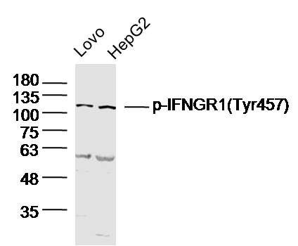 Insulin Receptor (phospho-Tyr999) antibody