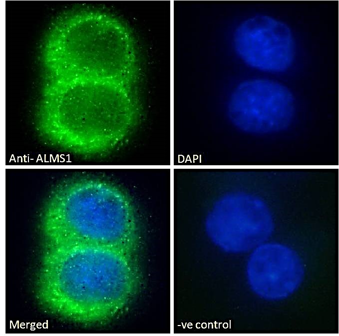 Goat anti-ALMS1 Antibody